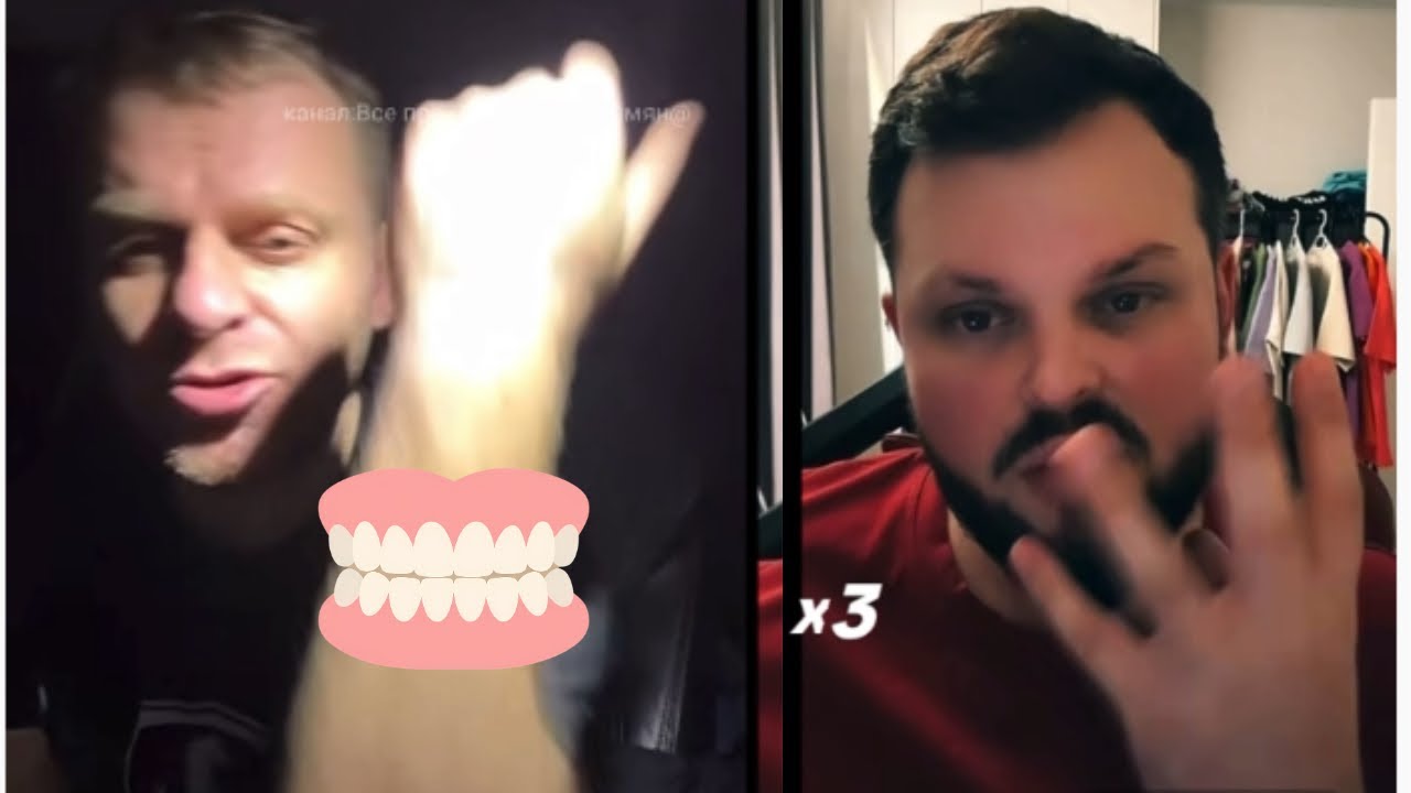 Самвел Адамян/YКУ СИЛИ В ТЕАТРЕ ЗА РYKY! У КОЛИ ГAЙМOPИТ!Срочн0 на мрт!