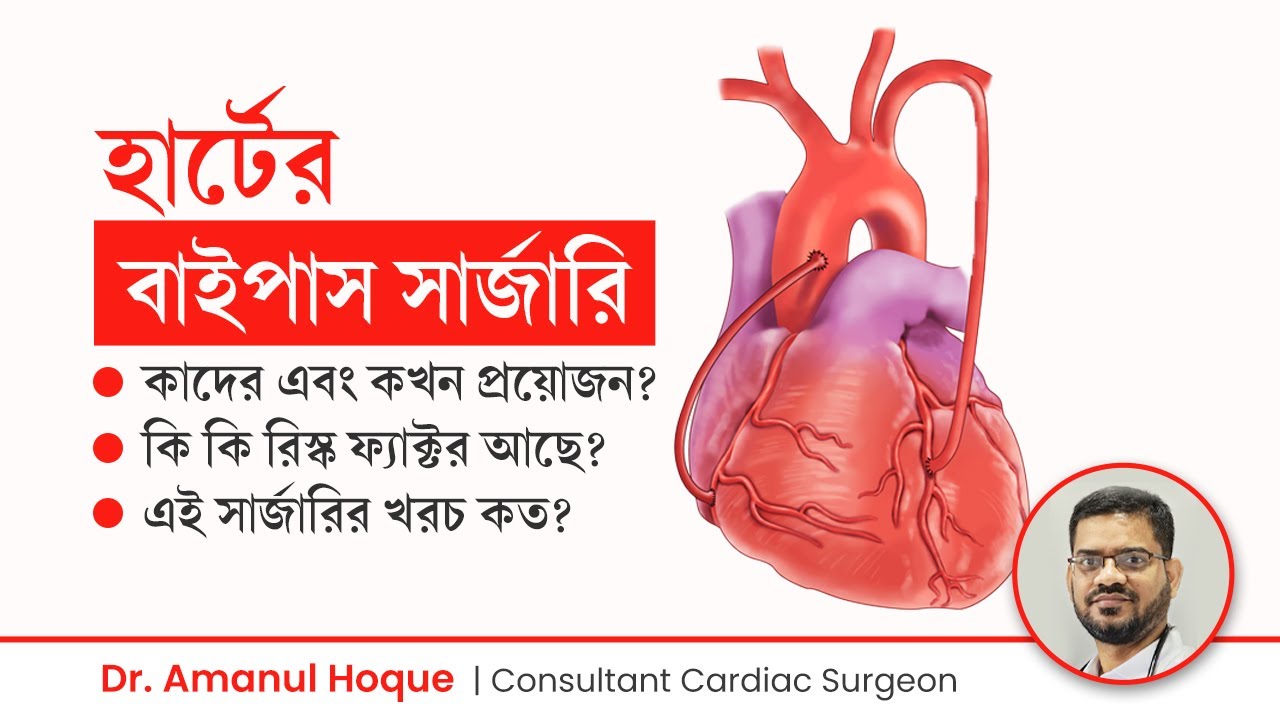 হার্টের বাইপাস সার্জারি কখন প্রয়োজন ও কাদের করতে হয় | বাইপাস কিভাবে করে   | Heart Bypass Surgery