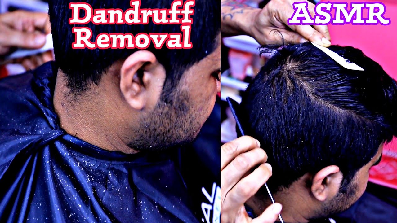 Most satisfying Dandruff removal with ASMR sound | Comb massage with dandruff treatment asmr
