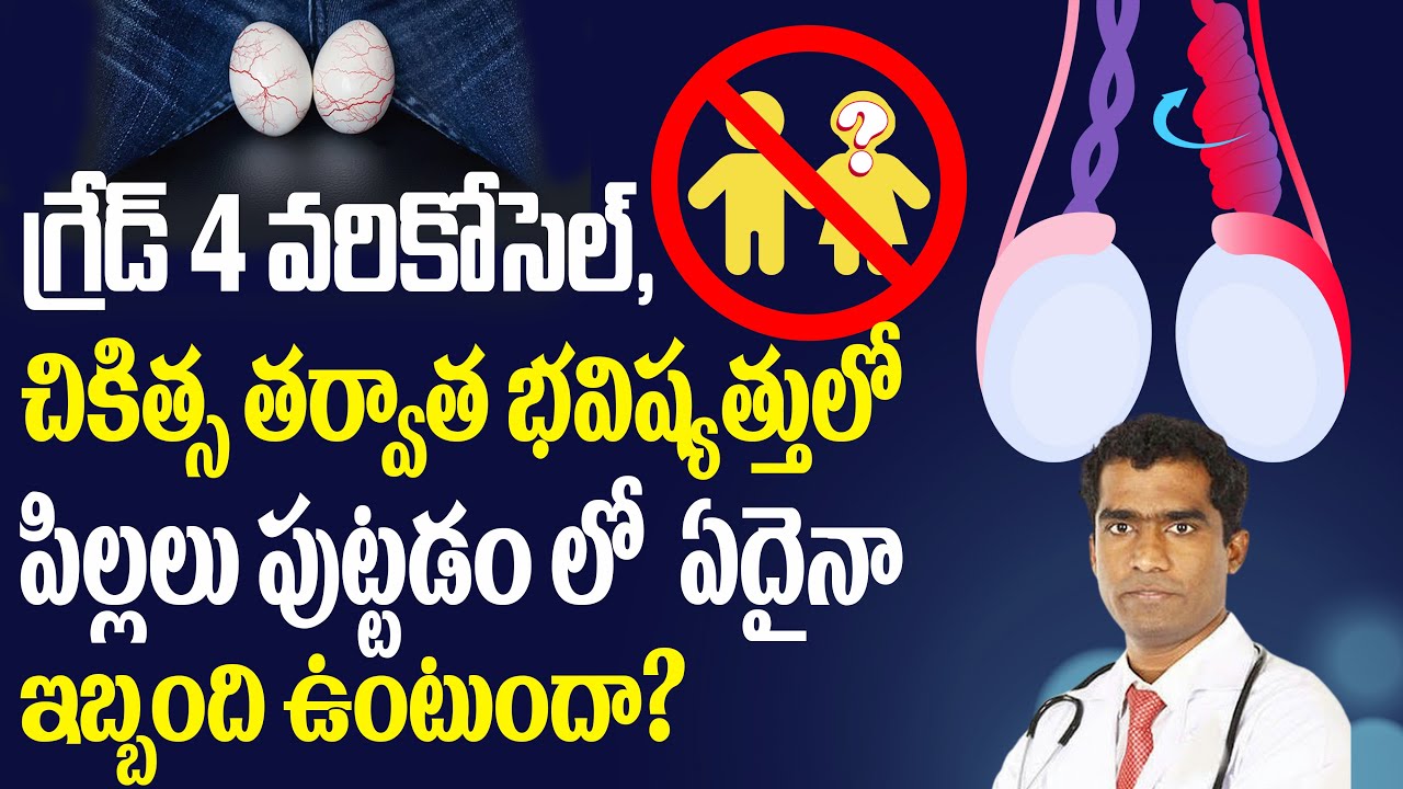గ్రేడ్ 4 వరికోసెల్ చికిత్స తర్వాత  పిల్లలు పుట్టడంలో?  varicocele reatment in Hyderabad. #varicocele