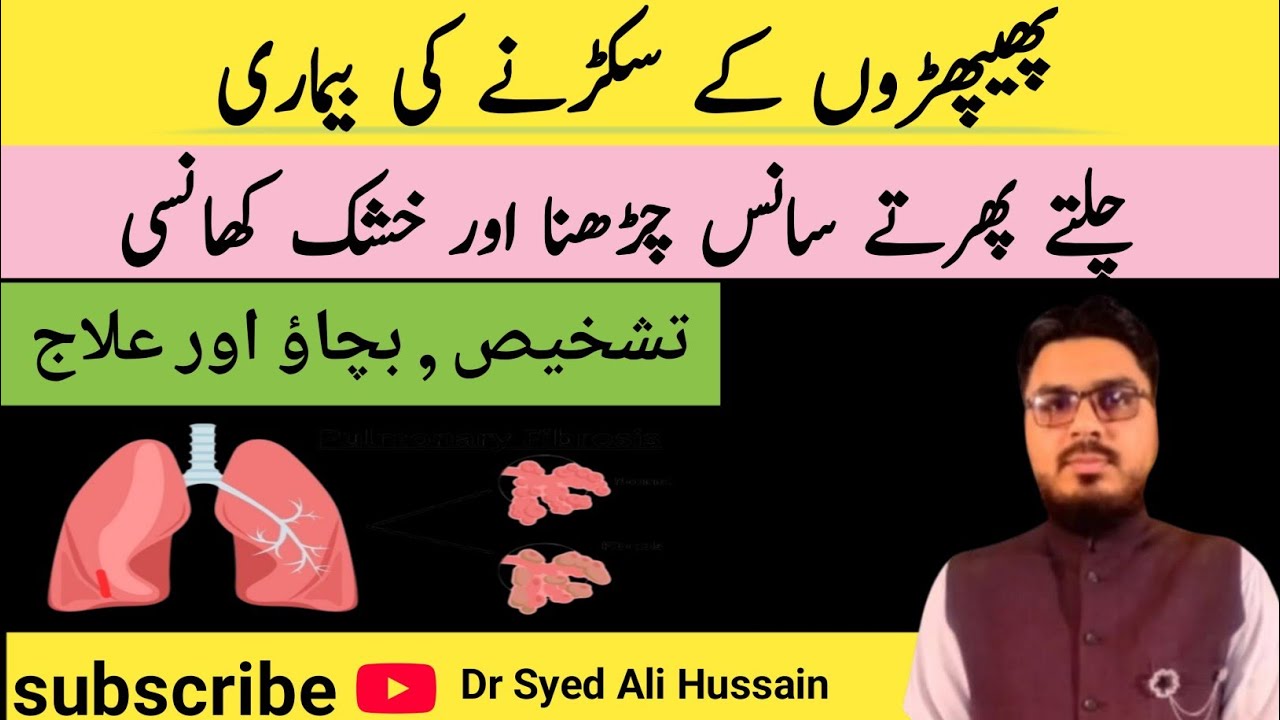 Phephron ki bemari ka ilaj  | Pulmonary Fibrosis Treatment In Urdu/Hindi | Dr Syed Ali Hussain