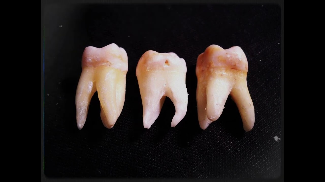 Dental. 