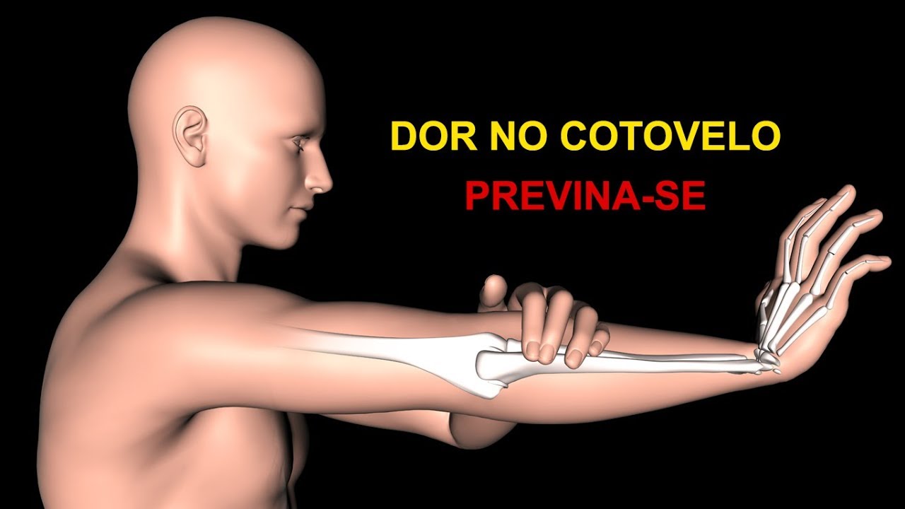 EPICONDILITE - Exercícios que ajudam a prevenir e aliviar a dor no cotovelo