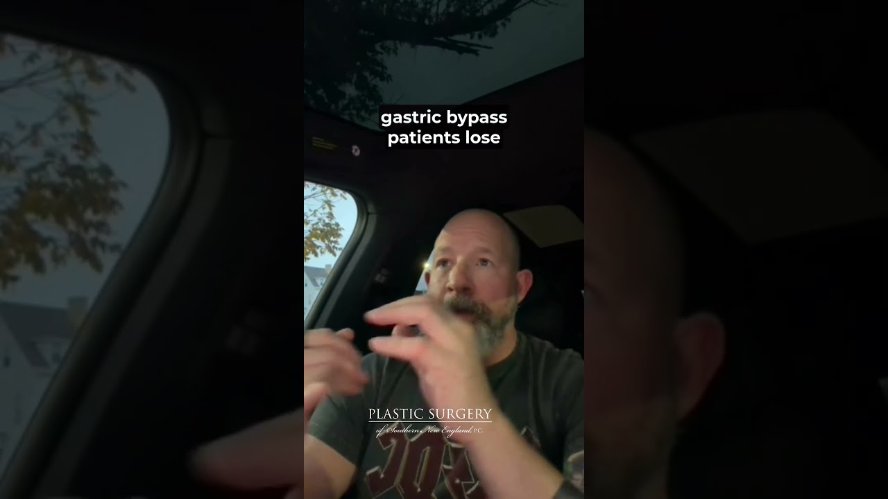 The Truth About &ldquo;Ozempic Face&rdquo; (From a Plastic Surgeon)