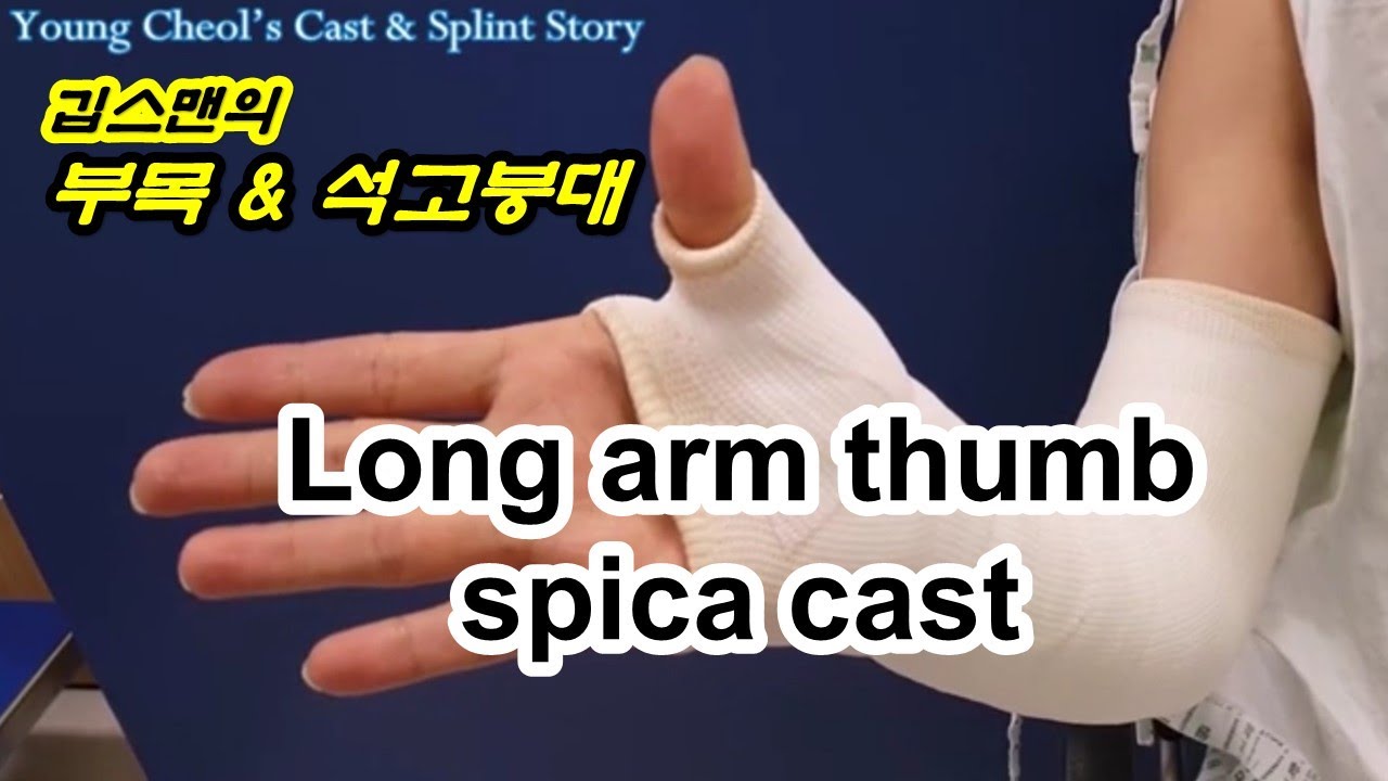 Long Arm Thumb Spica Cast