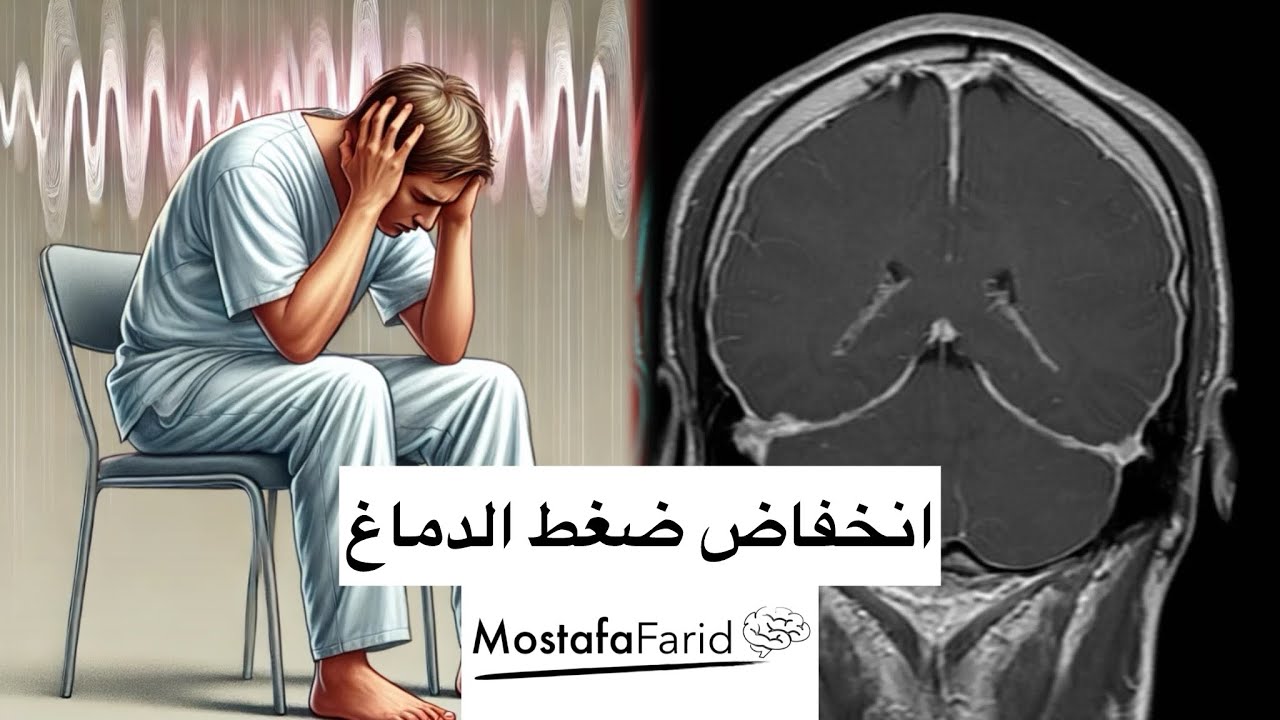 انخفاض ضغط الدماغ و تشابه اعراضه مع ارتفاع ضغط الدماغ