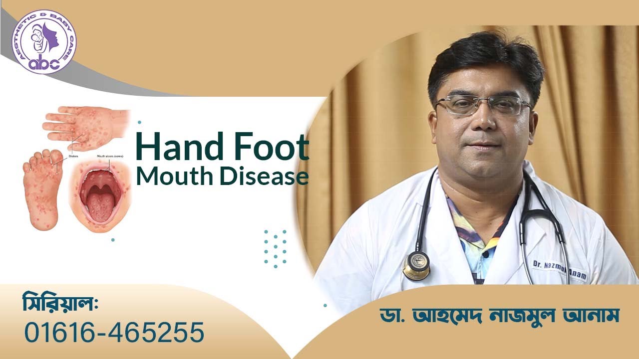 Hand Foot Mouth Disease।। ডাঃ আহমেদ নাজমুল আনাম || FCPS, MD- Assistant Professor, ICMH