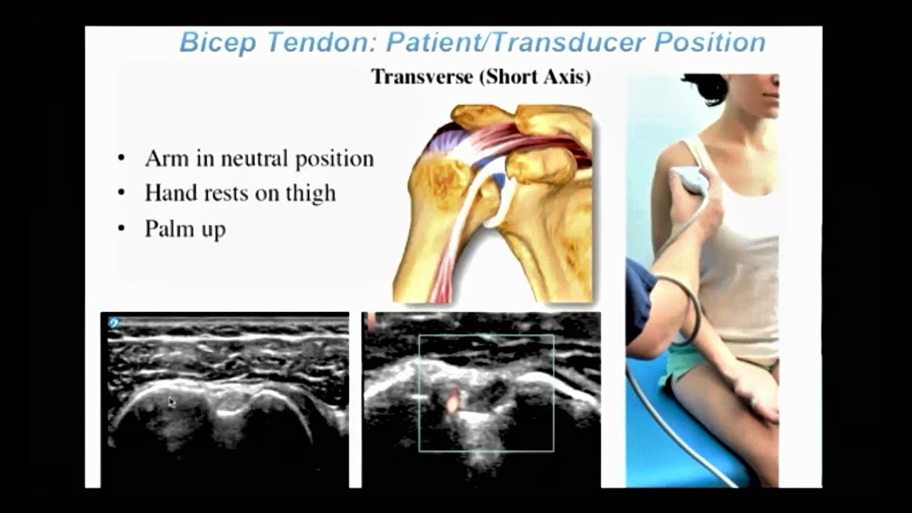 Webinar: Diagnostic Shoulder Exams - Anterior Shoulder