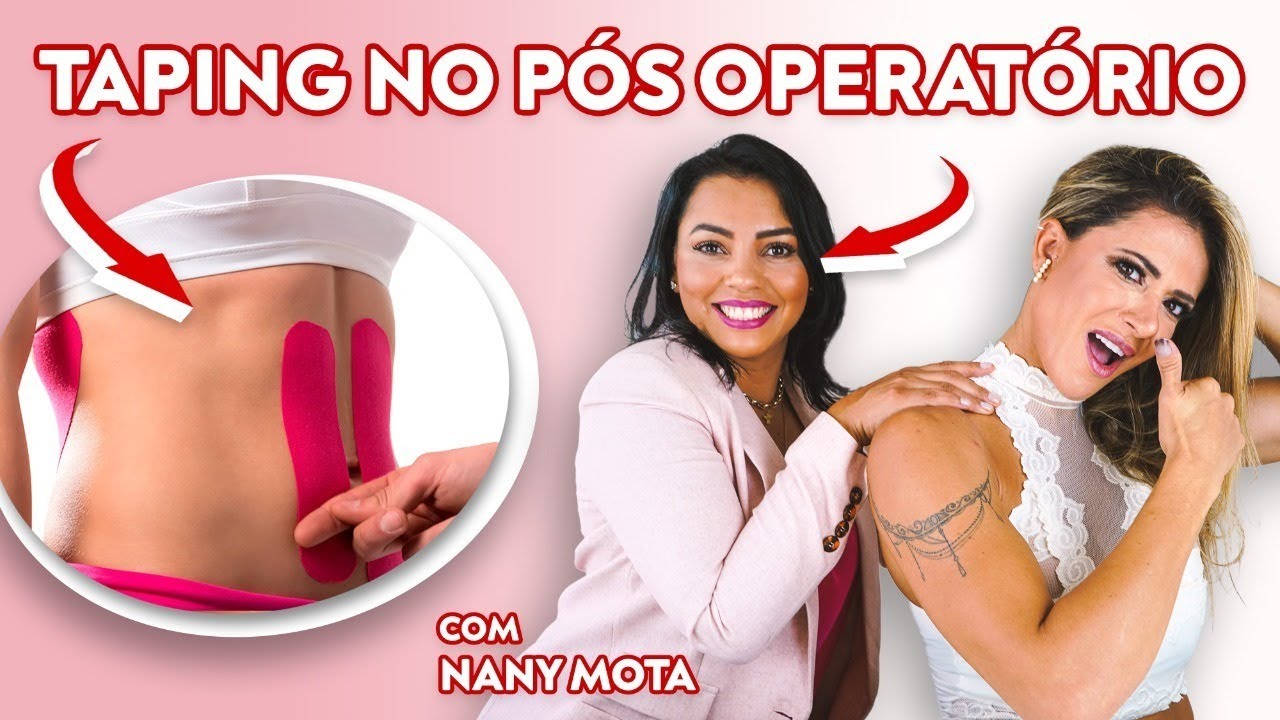 NANY MOTA EXPLICA COMO USAR O TAPPING NO PÓS OPERATÓRIO DE HIDROILIPO | LILI SPADA