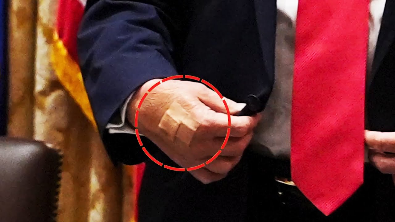 TRUMP HEALTH PANIC: NOW IT&rsquo;S BANDAGES