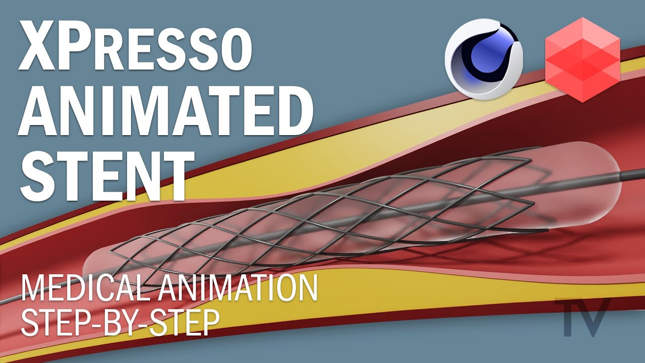 Build Realistic Medical Animations in Cinema 4D - Stent Placement