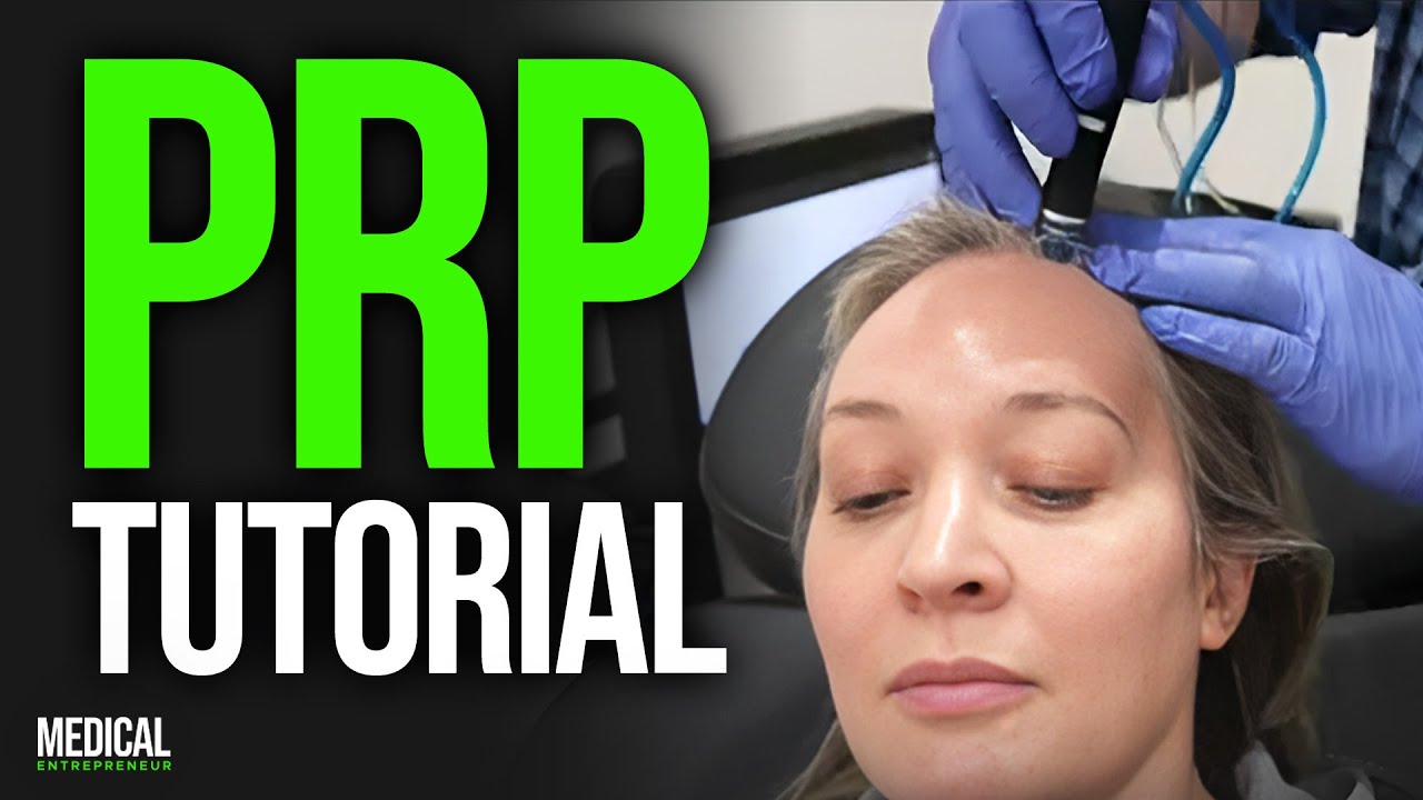 PRP Injections for Hair Loss | Full Procedure Demonstration