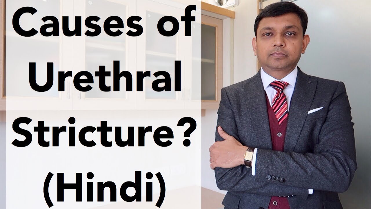 Causes of Urethral Stricture? | Hindi