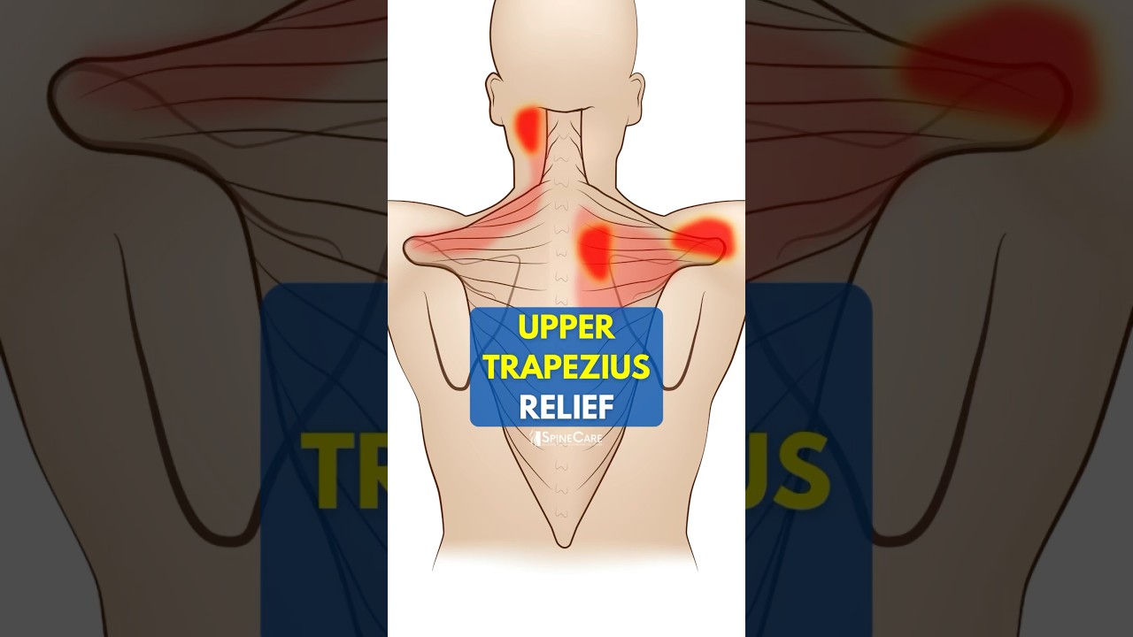 One Move for Instant Upper Trapezius Pain Relief