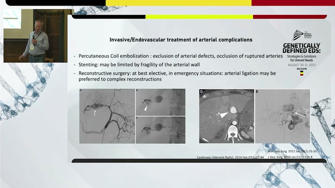 2023 Cardiovascular Manifestations and Follow-up in Adults - Michael Frank