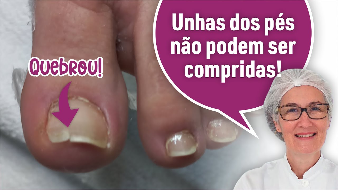 UNHA COMPRIDA PODE QUEBRAR