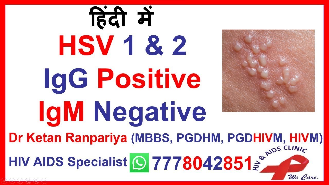 HSV IgG Positive: Understanding Your Results With Dr. Ketan Ranpariya