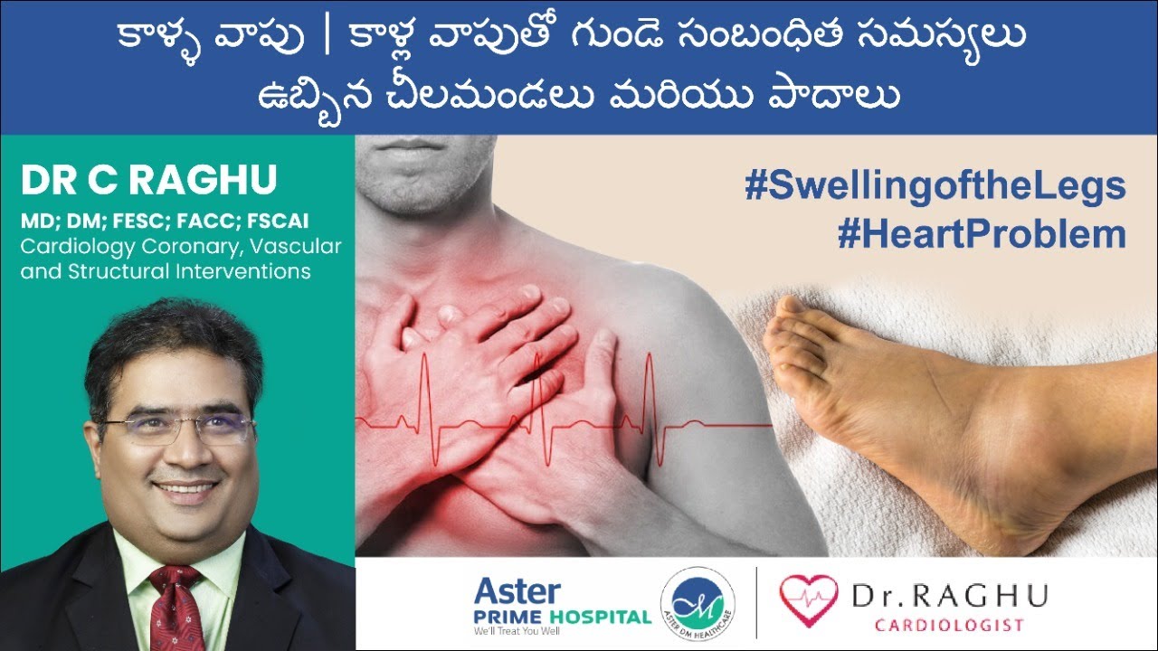 Swelling of the legs | Heart related problems with swelling of the legs | Swollen Ankles and Feet