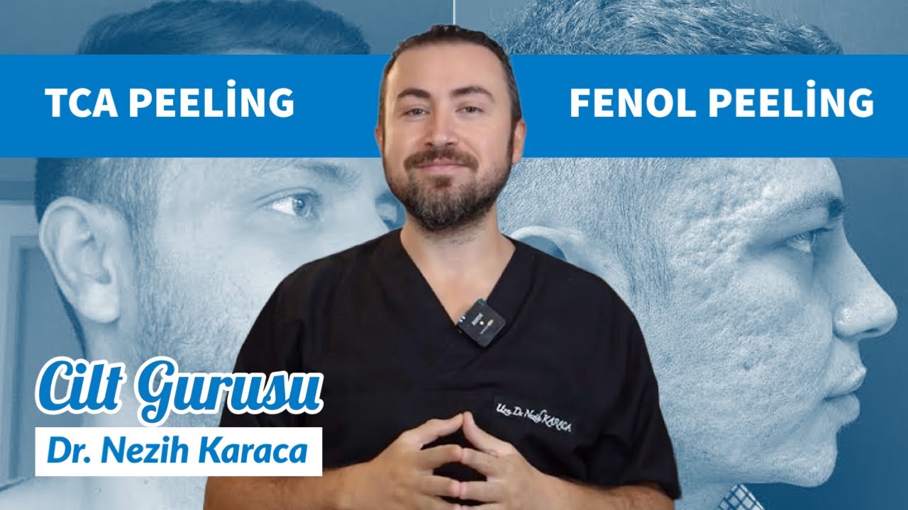 TCA ve FENOL PEELİNG