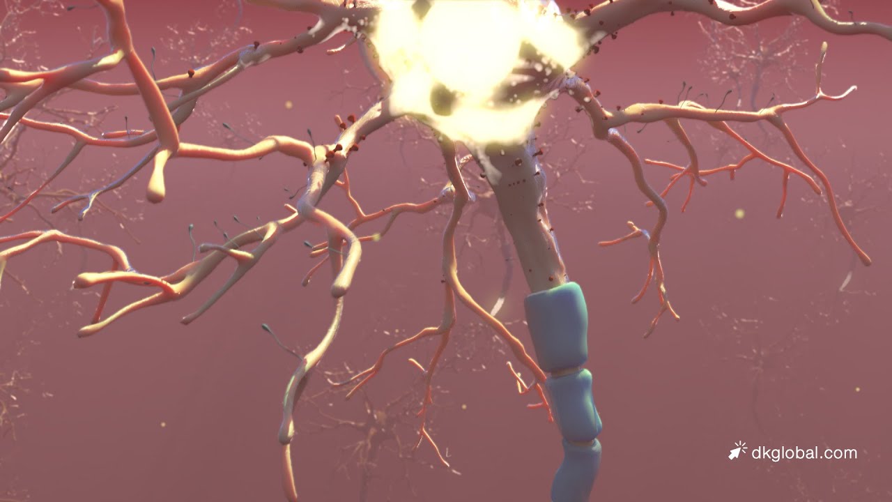 $925K Settlement After Shifting Focus from Soft Tissue Injuries to TBI