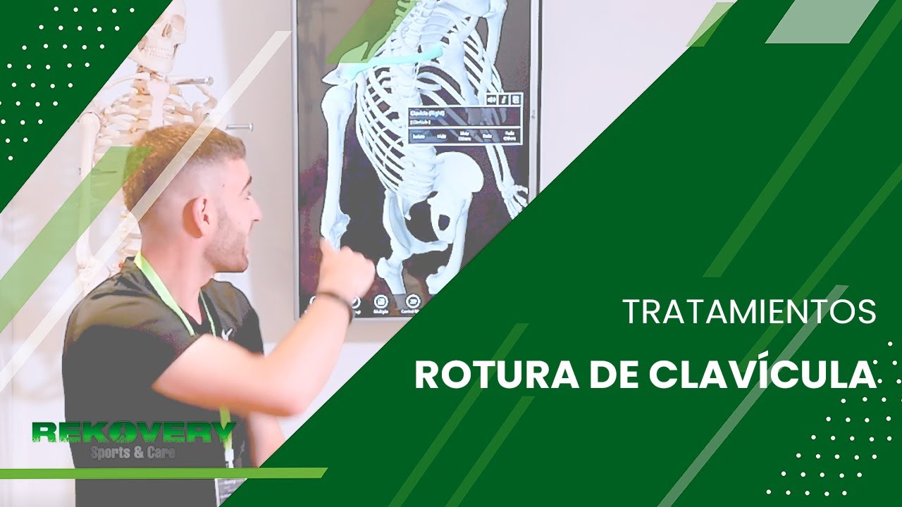 Ejercicios de rehabilitación para roturas de clavícula en Clínica Rekovery