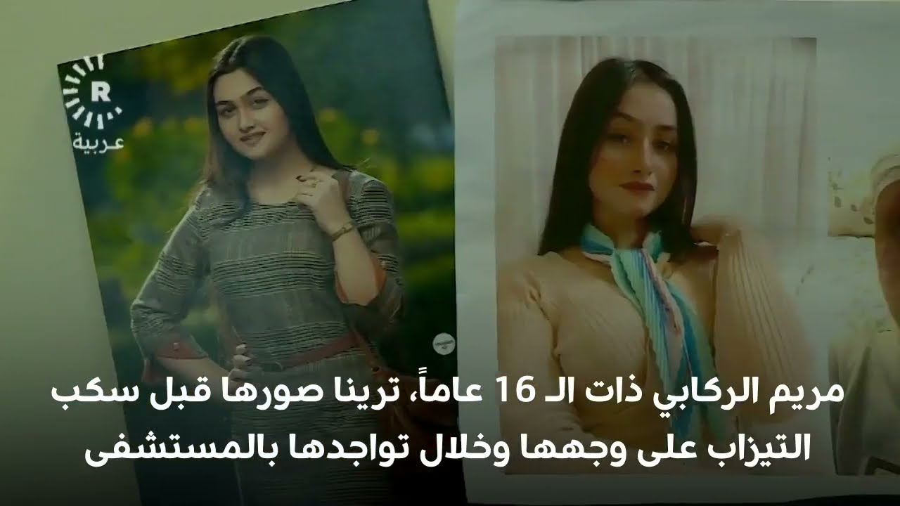 عن لسان الأميرة مريم رووداو تنقل تفاصيل حادثة سكب الأسيد على جسمها ووجهها العملية تكلف 200 ألف دولار