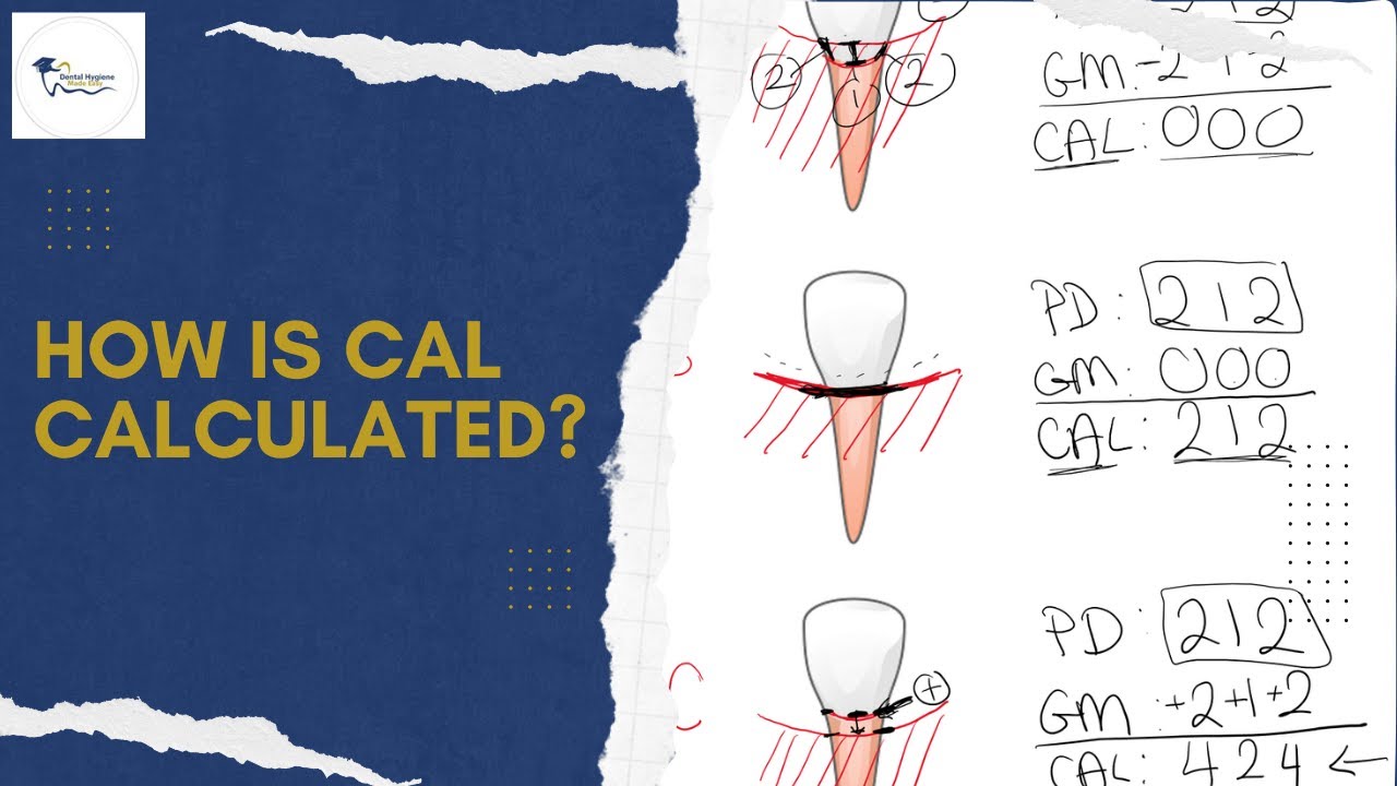 Как рассчитывается CAL?