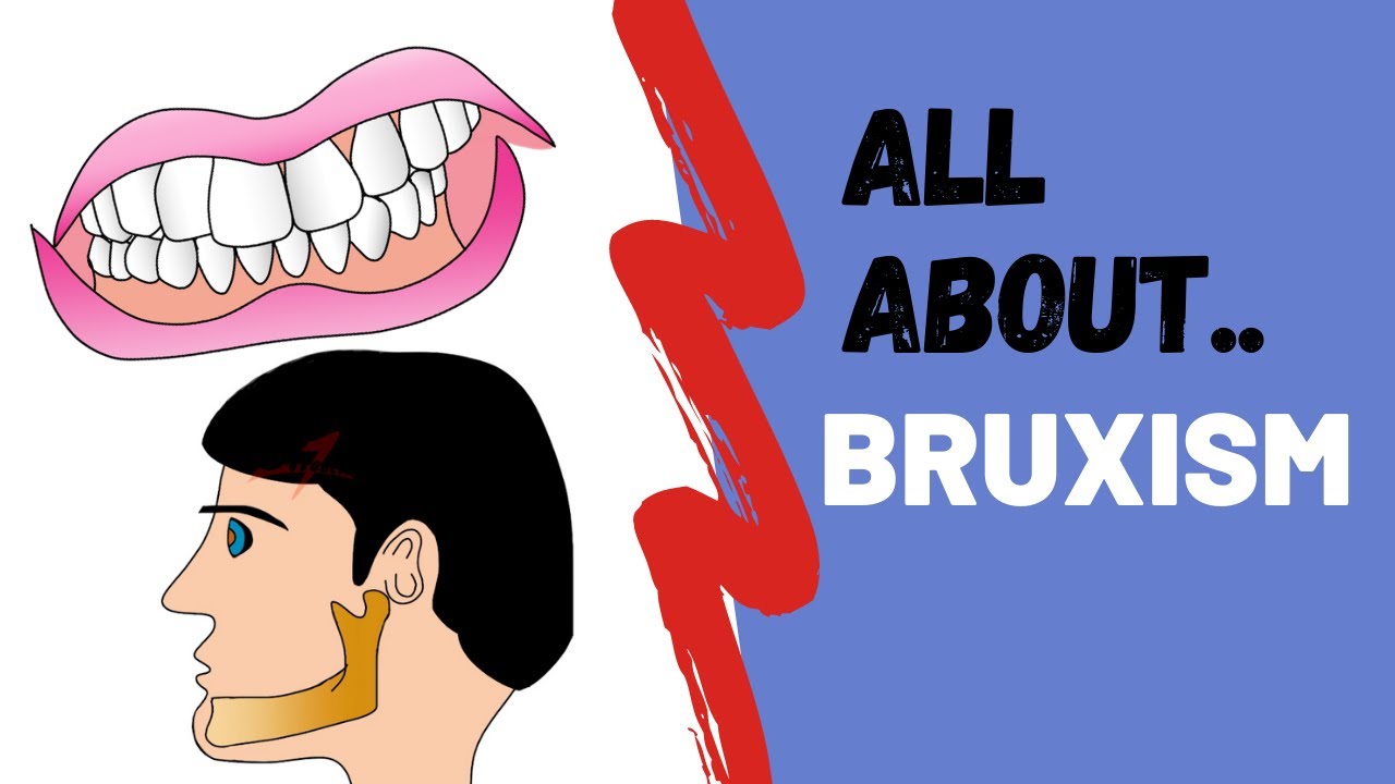 All About Bruxism