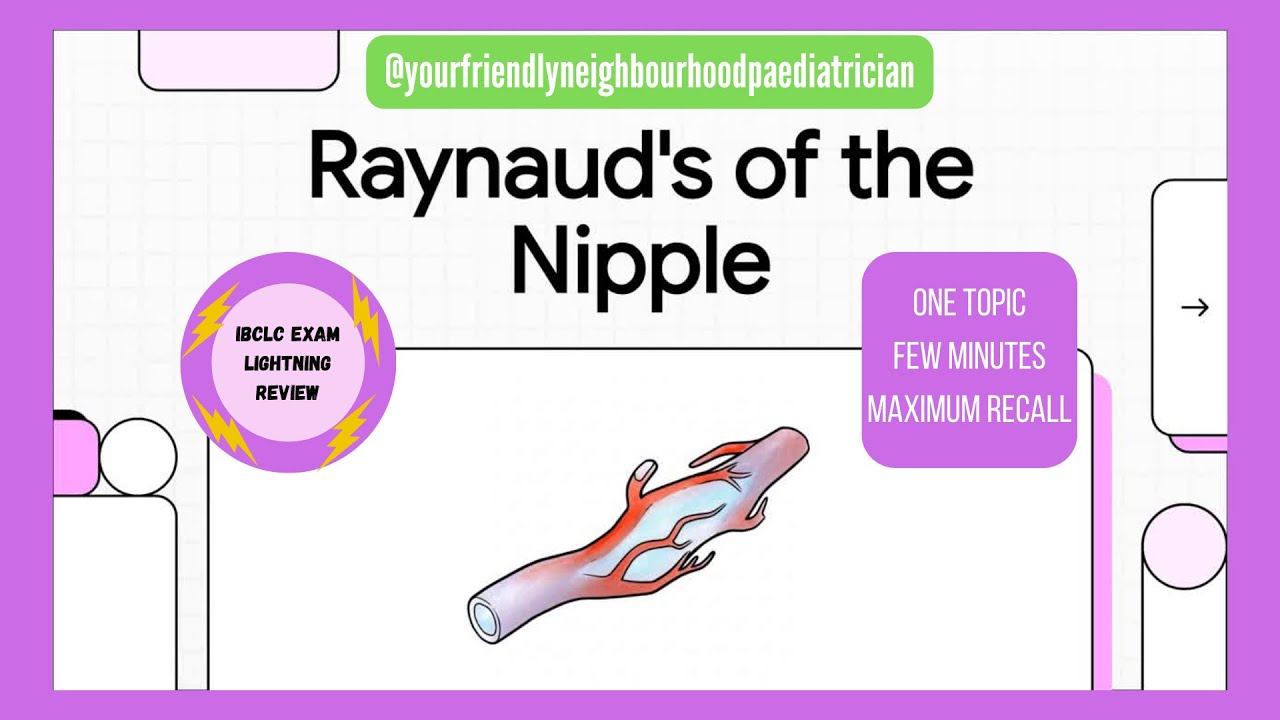 Raynaud&rsquo;s Phenomenon of the Nipple | IBCLC Exam Lightning Review