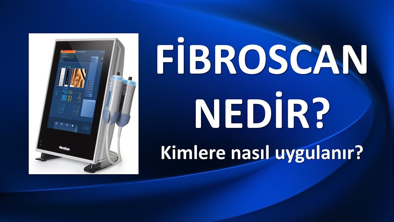 FibroScan Nedir? Kimlere, Nasıl Uygulanır?