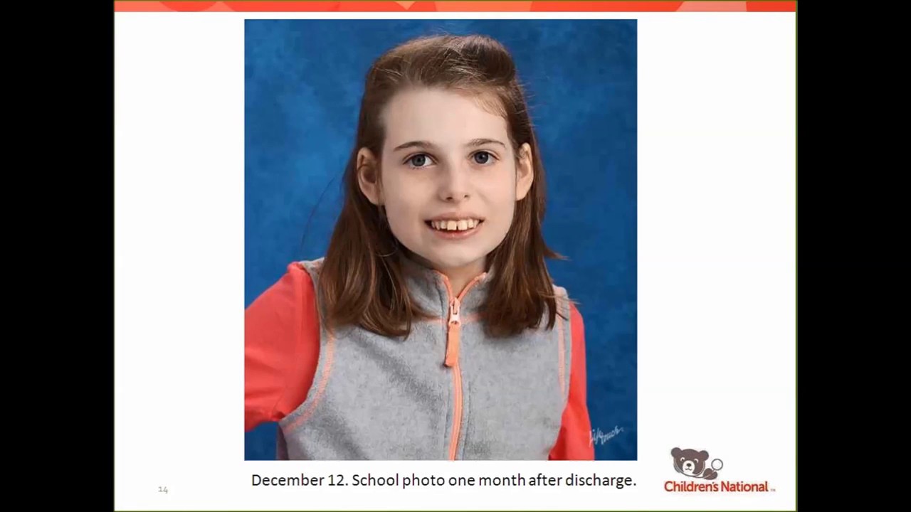 Pediatric Sepsis: From Start to Finish