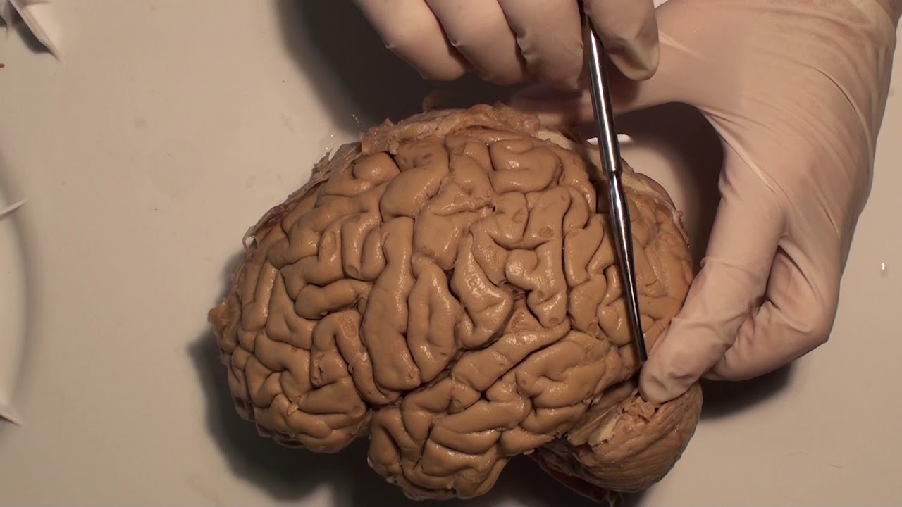 Parietal Lobe