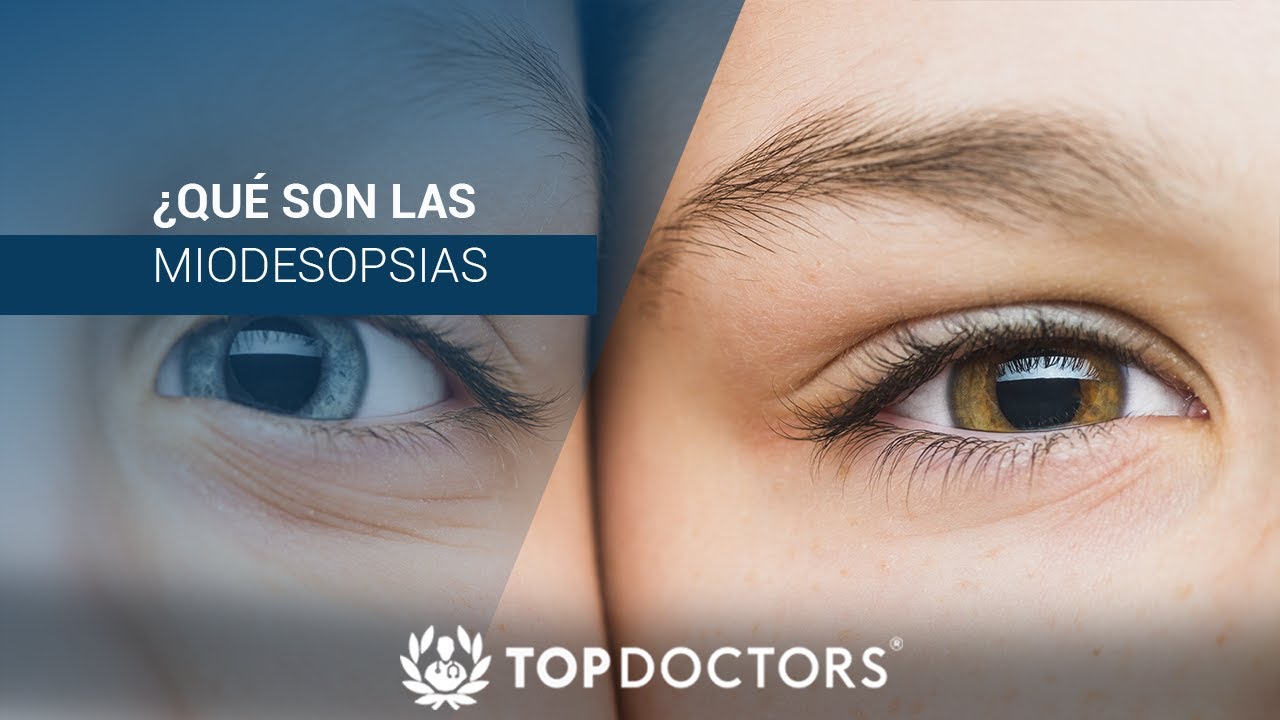 ¿Qué son las Miodesopsias?