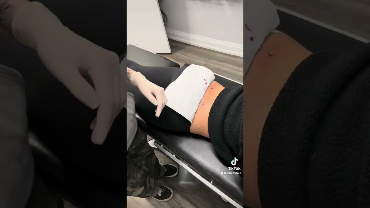 Back Dermal Piercings by Gwen at Xtremities | Mississauga&rsquo;s Trusted Tattoo & Piercing Studio