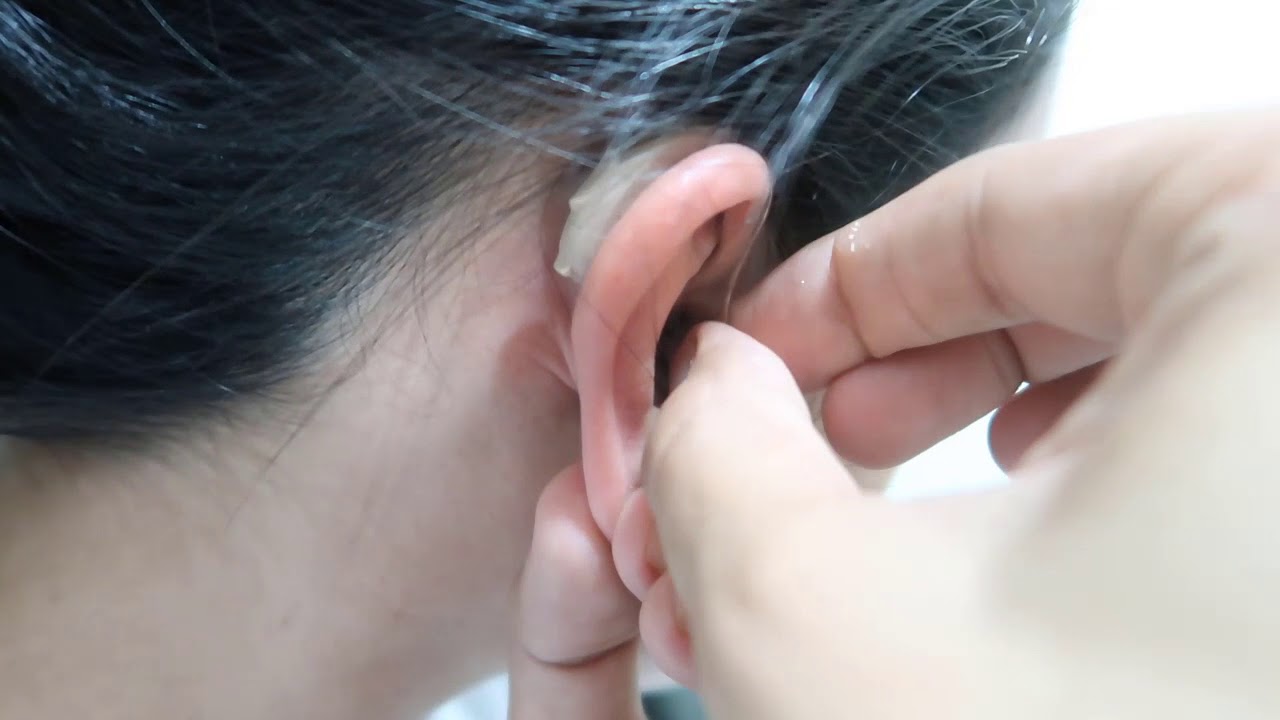 Aparelho Auditivo Rexton Emerald - Como Colocar