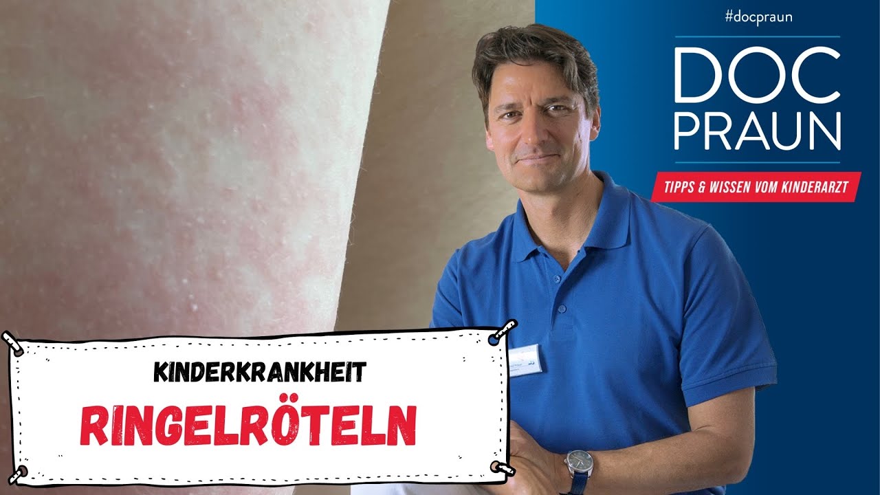 Ringelröteln