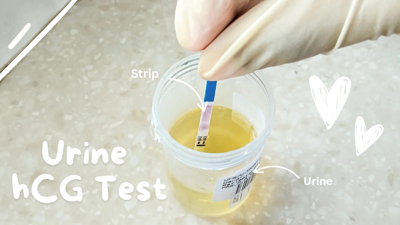 Urine hCG test 🌸🔬 How to run a pregnancy test | Pregnancy strip test for early testing | How to use