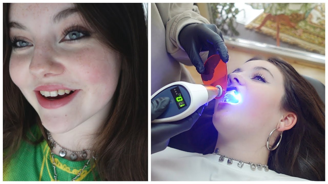 IK BEN JARIG! & TOOTH GEM ZETTEN - BIBI WEEKVLOG