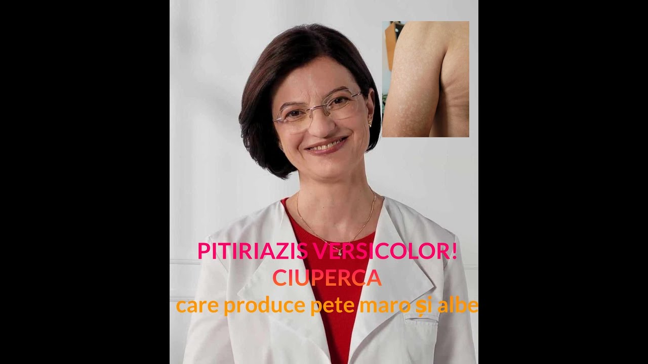 PITIRIAZIS VERSICOLOR- TINEA VERSICOLOR - CAUZE ȘI TRATAMENT