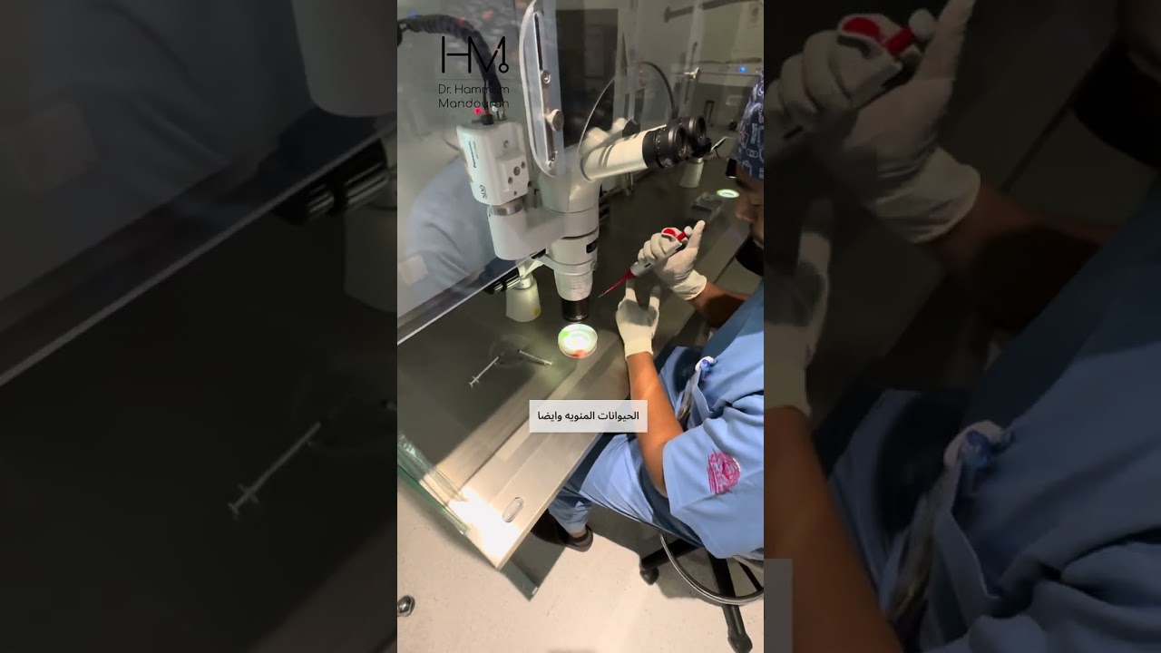 مراحل عملية التفتيش المجهري والحقن المجهري - همام مندورة