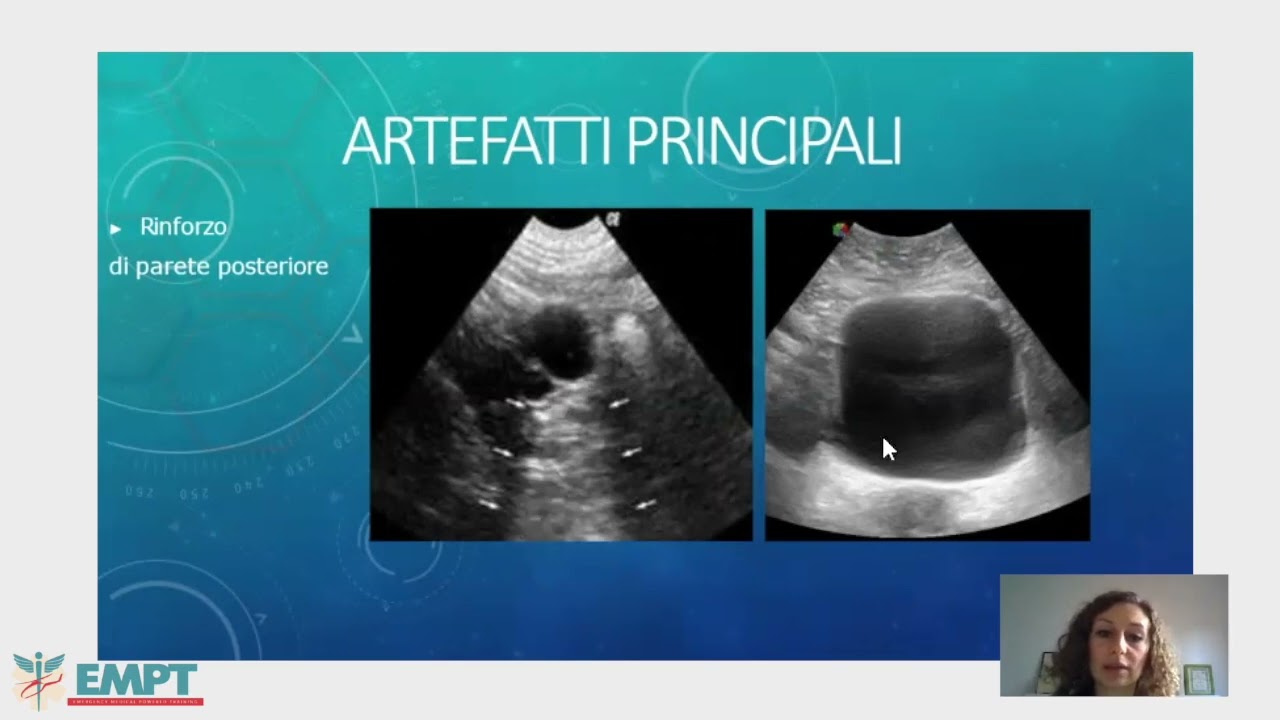 Ecografia applicata al CadaverLab - Isabella Garancini