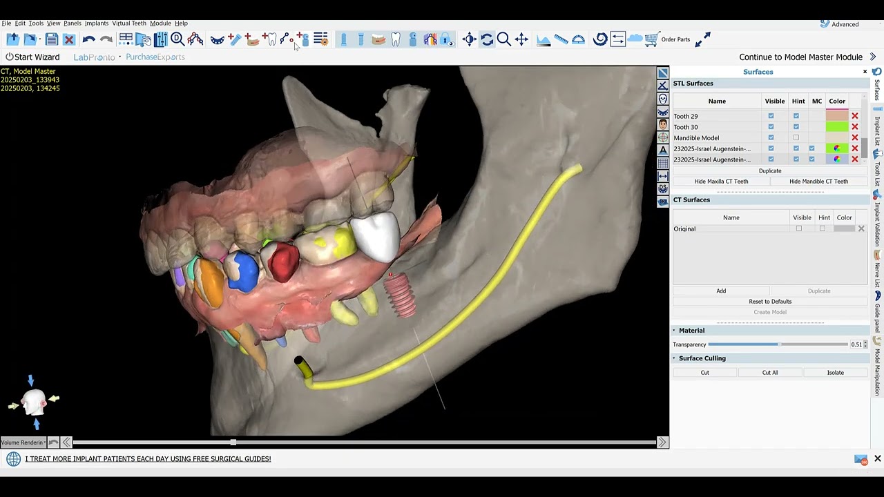 #18 Surgical Guide in minutes --- FREE!