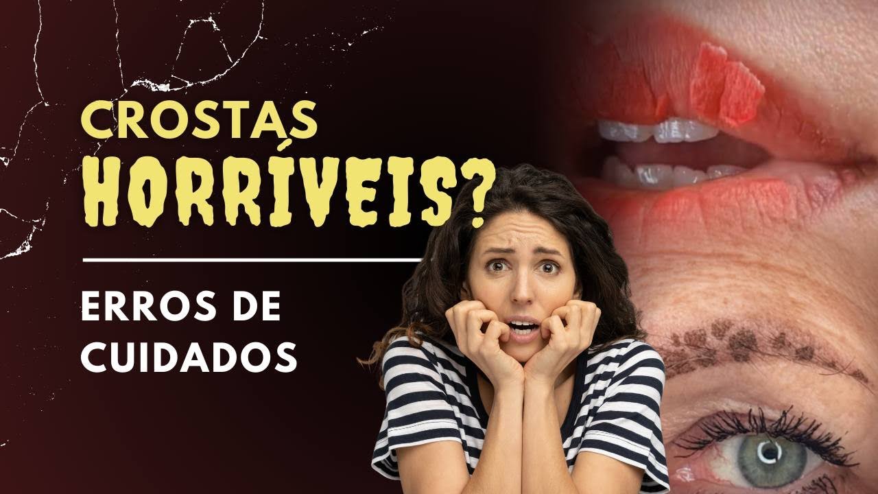 CROSTAS FEIAS APÓS PMU? O ERRO ESTÁ NO CUIDADO EM CASA!