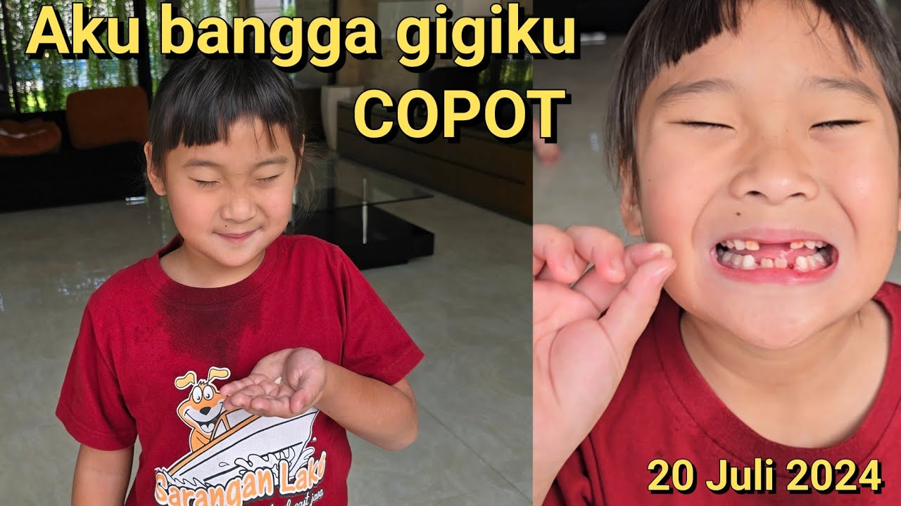 Gigi susu Jenica copot.. GOOD JOB
