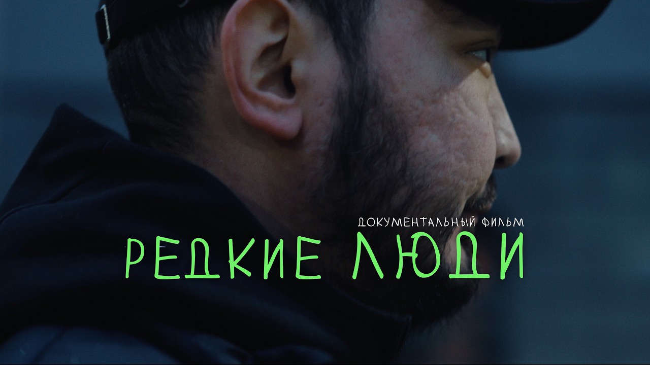 Редкие люди: истории людей с редкими заболеваниями