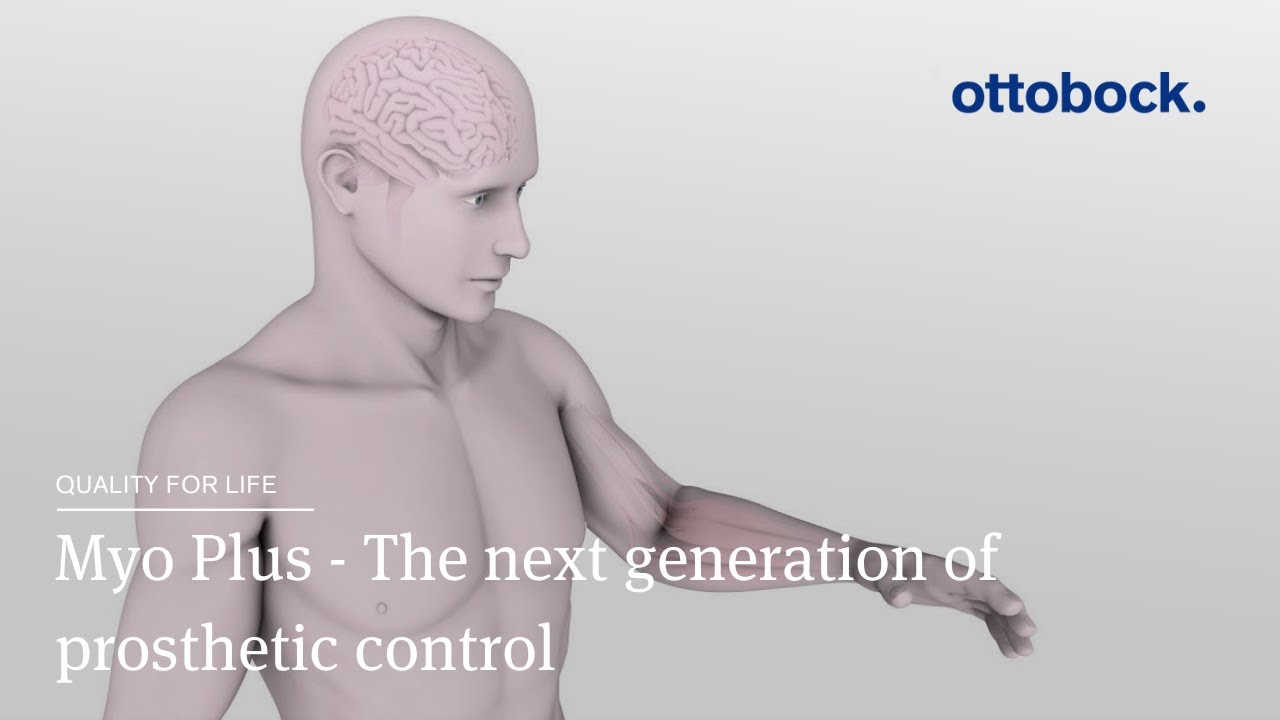 Myo Plus Pattern Recognition - The next generation of prosthetic control | Ottobock