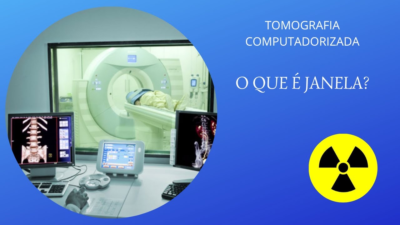 [JANELA]: Você sabe o que é janelamento em tomografia computadorizada?
