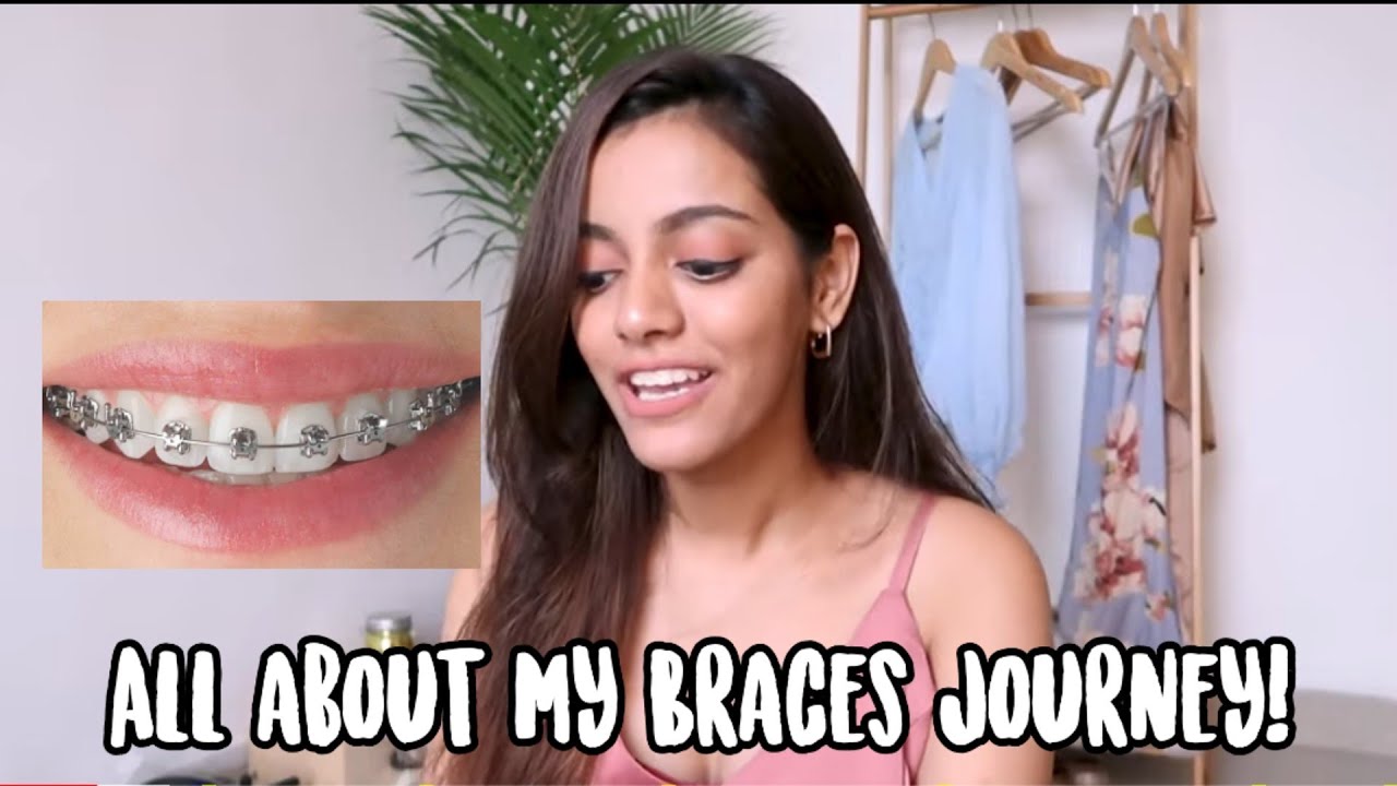 All about my braces journey | Q&A cost, duration, treatment, ceramic, Invisalign or metallic type