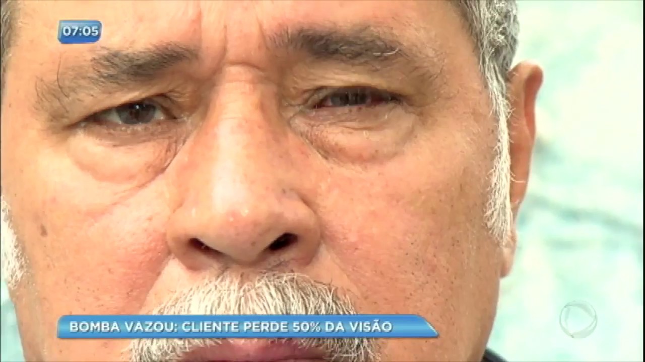 Xerife do Consumidor: cliente perde 50% da visão após vazamento de bomba de gasolina