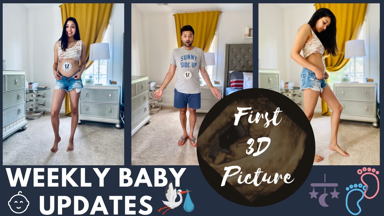 Weekly Baby Update - First 3D Ultrasound Pic & NT Test | The Lifestyle Vloggers - Daily Vlog